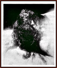 Borden autopsy photo 1